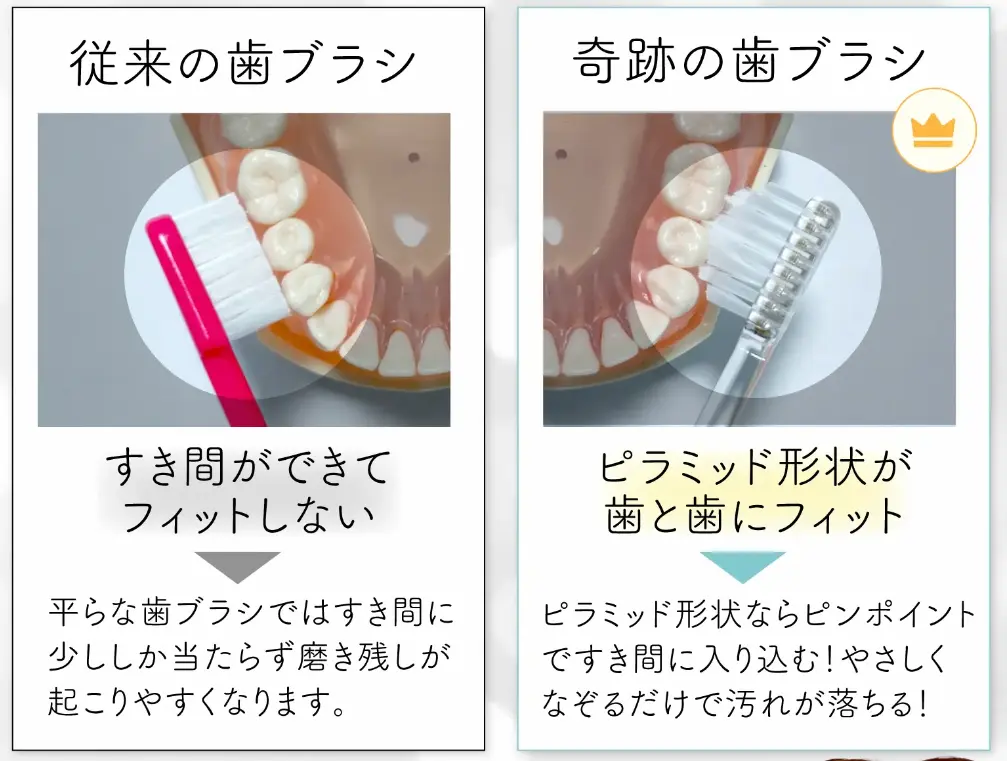 奇跡の歯ブラシが噓くさい